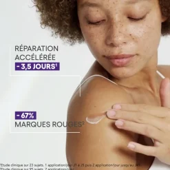 A-derma Crèmes De Jour|Crème Réparatrice Anti-Marques SPF50+