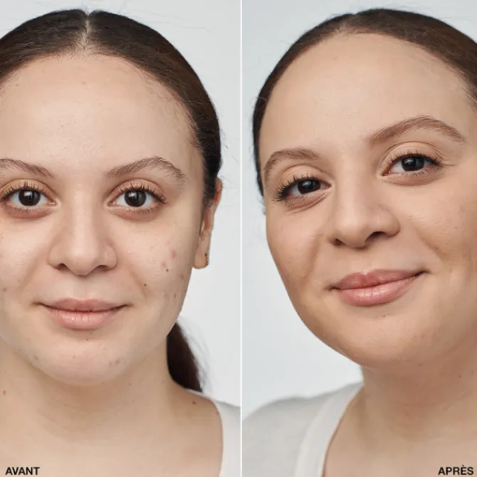 Clinique Fond De Teint Fluide|Even Better Clinical