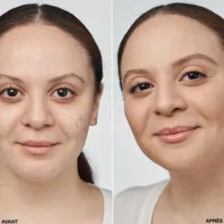 Clinique Fond De Teint Fluide|Even Better Clinical