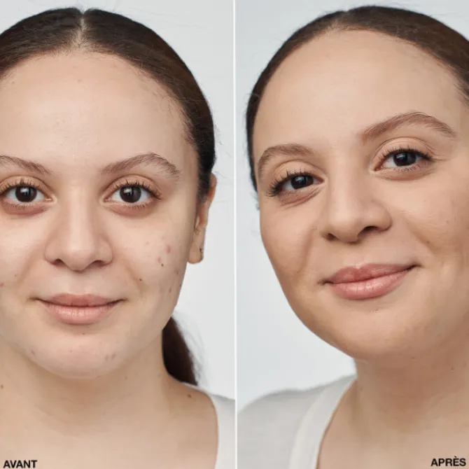 Clinique Fond De Teint Fluide|Even Better Clinical