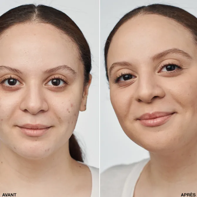 Clinique Fond De Teint Fluide|Even Better Clinical