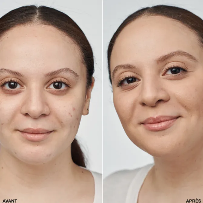 Clinique Fond De Teint Fluide|Even Better Clinical