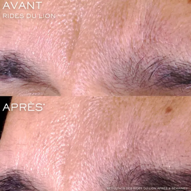 Lancome Sérum>Rénergie C.R.x. Triple Sérum Rétinol