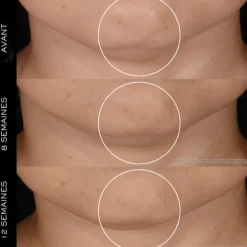 Lancome Crème De Jour></noscript>Rénergie H.P.N. 300-Peptide