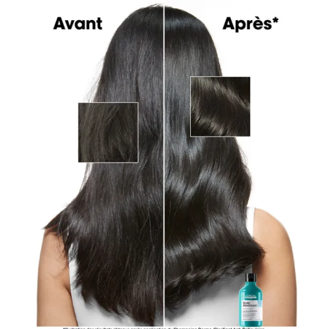 L'Oreal Professionnel Cuir Chevelu Sensible / Pellicules|Shampooing>Scalp Advanced