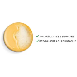 Vichy Shampooings|Cuir Chevelu Sensible / Pellicules|Shampooing traitant pellicules & démangeaisons