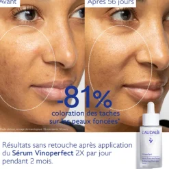 Caudalie Sérums & Huiles|Sérum><noscript><img width=