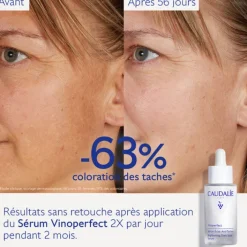 Caudalie Sérums & Huiles|Sérum><noscript><img width=