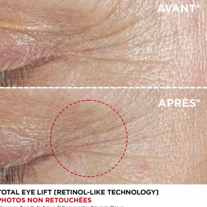 Clarins Soin Des Yeux & Lèvres>Total Eye Lift